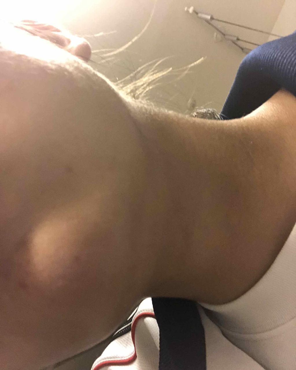 ハトムギ化粧水(ナチュリエ スキンコンディショナー R )/ナチュリエ/化粧水を使ったクチコミ(1枚目)