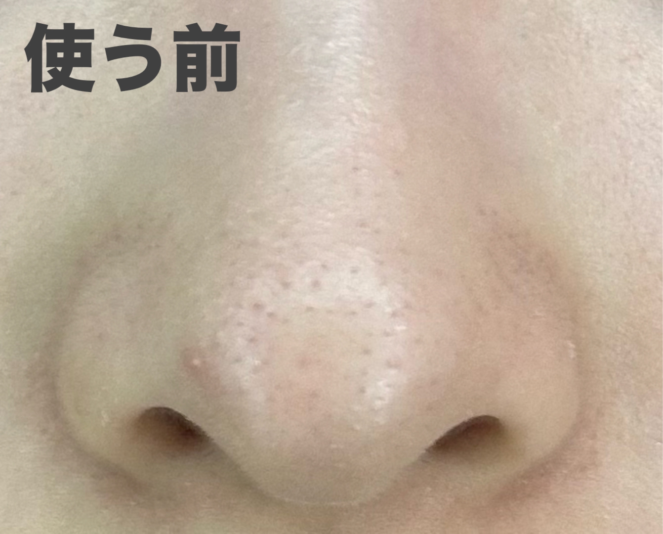 おうちdeエステ 肌をなめらかにするマッサージ洗顔ジェル 炭/ビオレ/その他洗顔料を使ったクチコミ（2枚目）