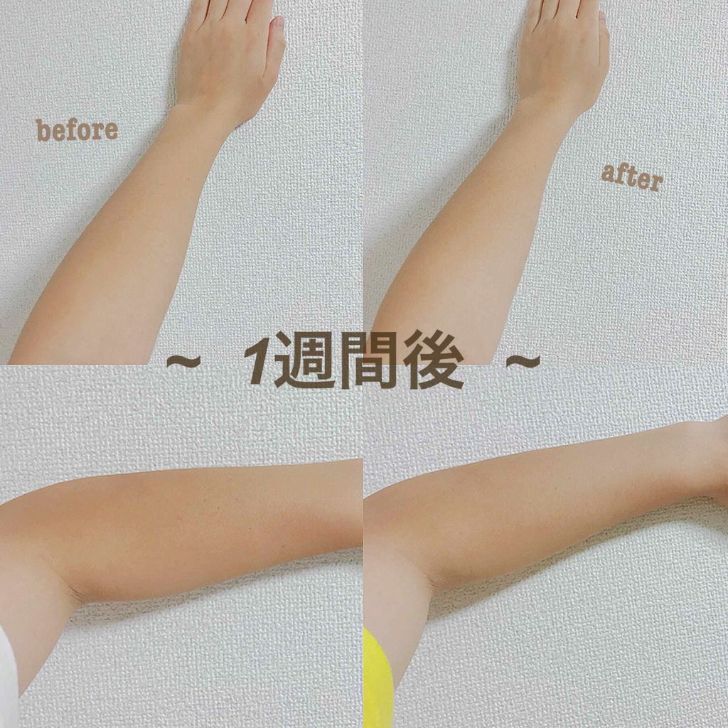 DHC はとむぎエキス/DHC/健康サプリメントを使ったクチコミ(2枚目)