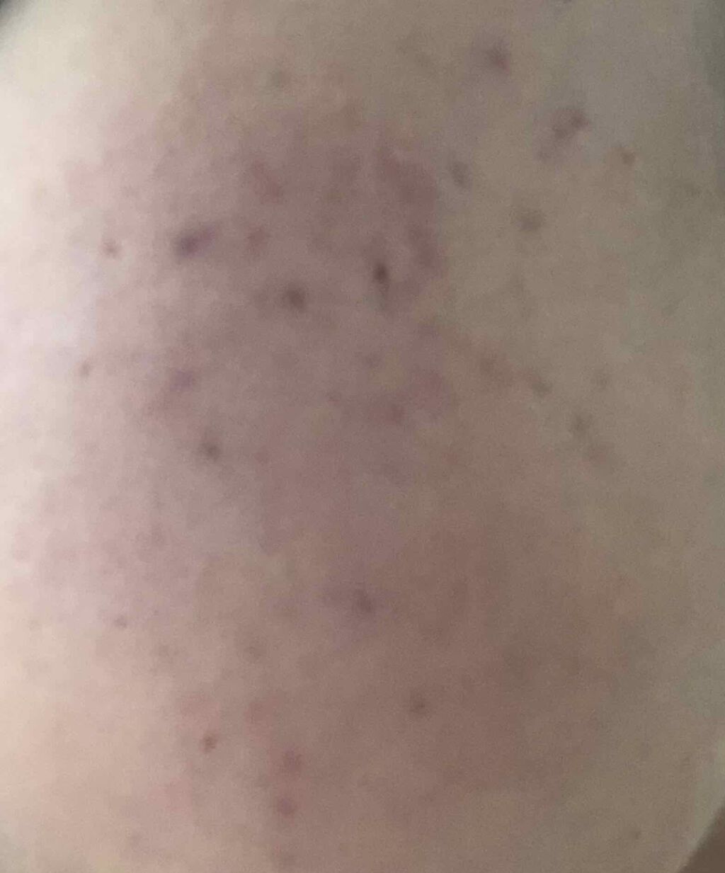 敏感肌用薬用美白美容液/無印良品/美容液を使ったクチコミ（3枚目）