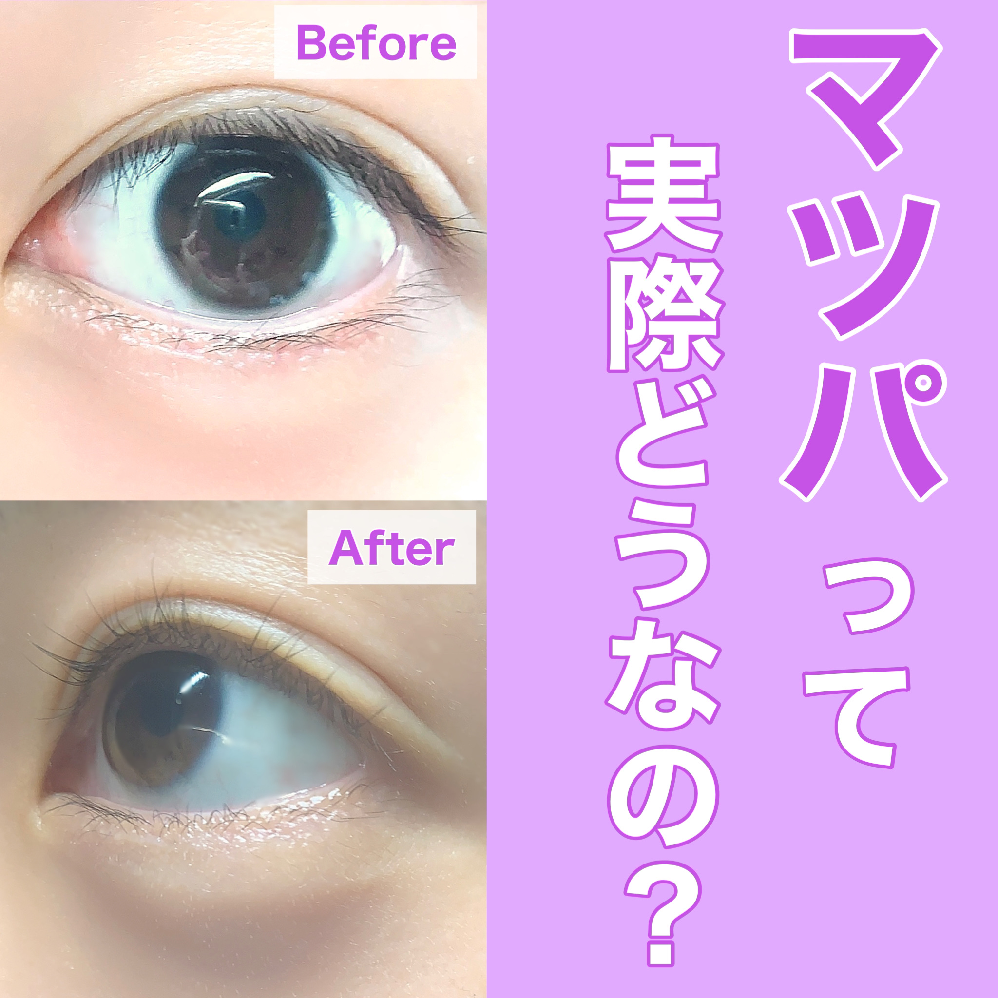 まつげ美容液EX/CEZANNE/まつげ美容液を使ったクチコミ（1枚目）