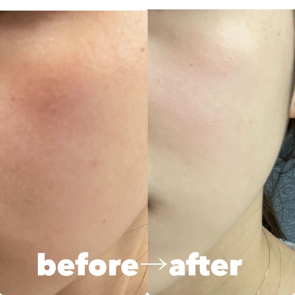 ネオクッション マット/LANEIGE/クッションファンデーションを使ったクチコミ(4枚目)