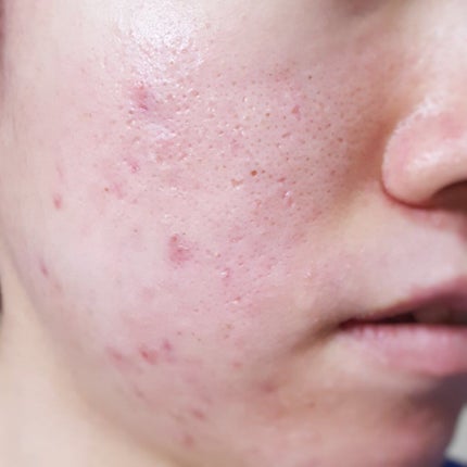 フィニッシングパウダー パールラメ入り/チャコット・コスメティクス/ルースパウダーを使ったクチコミ(4枚目)