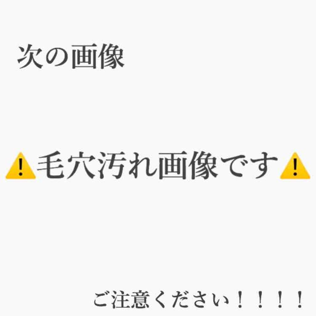 リアルカレンデュラピールオフパック/APRILSKIN/ピーリングを使ったクチコミ(3枚目)
