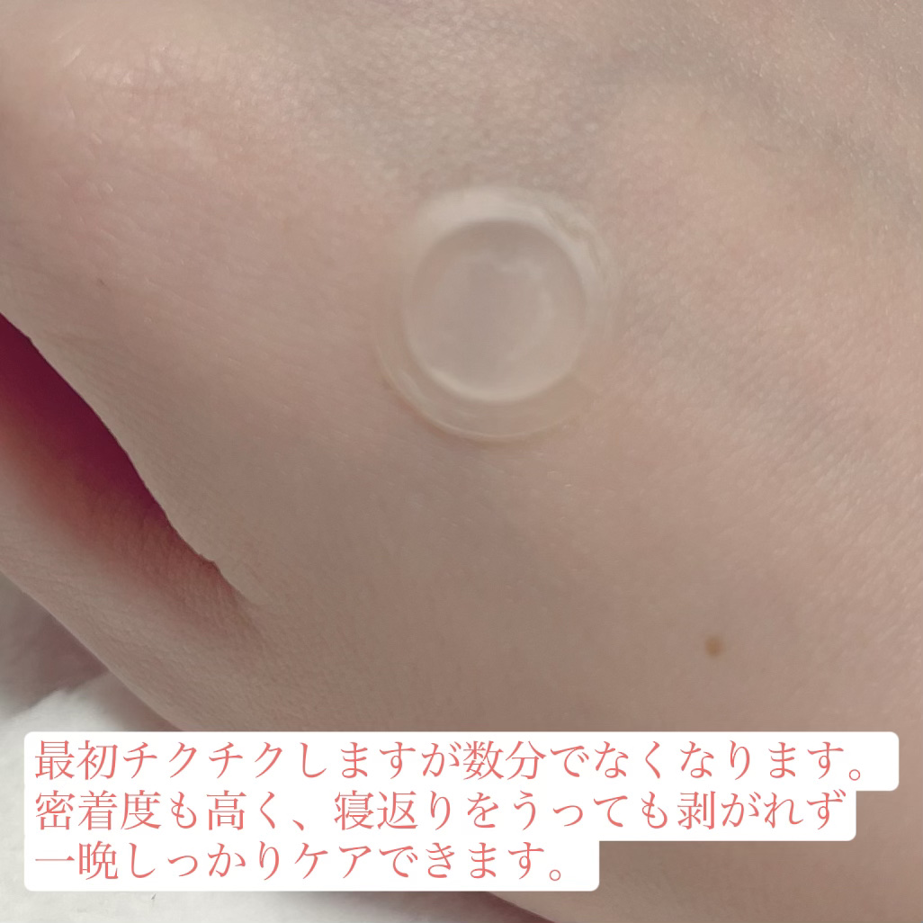 エーキュアショットスポットパッチ/obsero/にきびパッチを使ったクチコミ（3枚目）