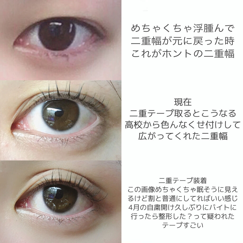 のびーるアイテープ（絆創膏タイプ、レギュラー）/DAISO/二重まぶた用アイテムを使ったクチコミ（2枚目）