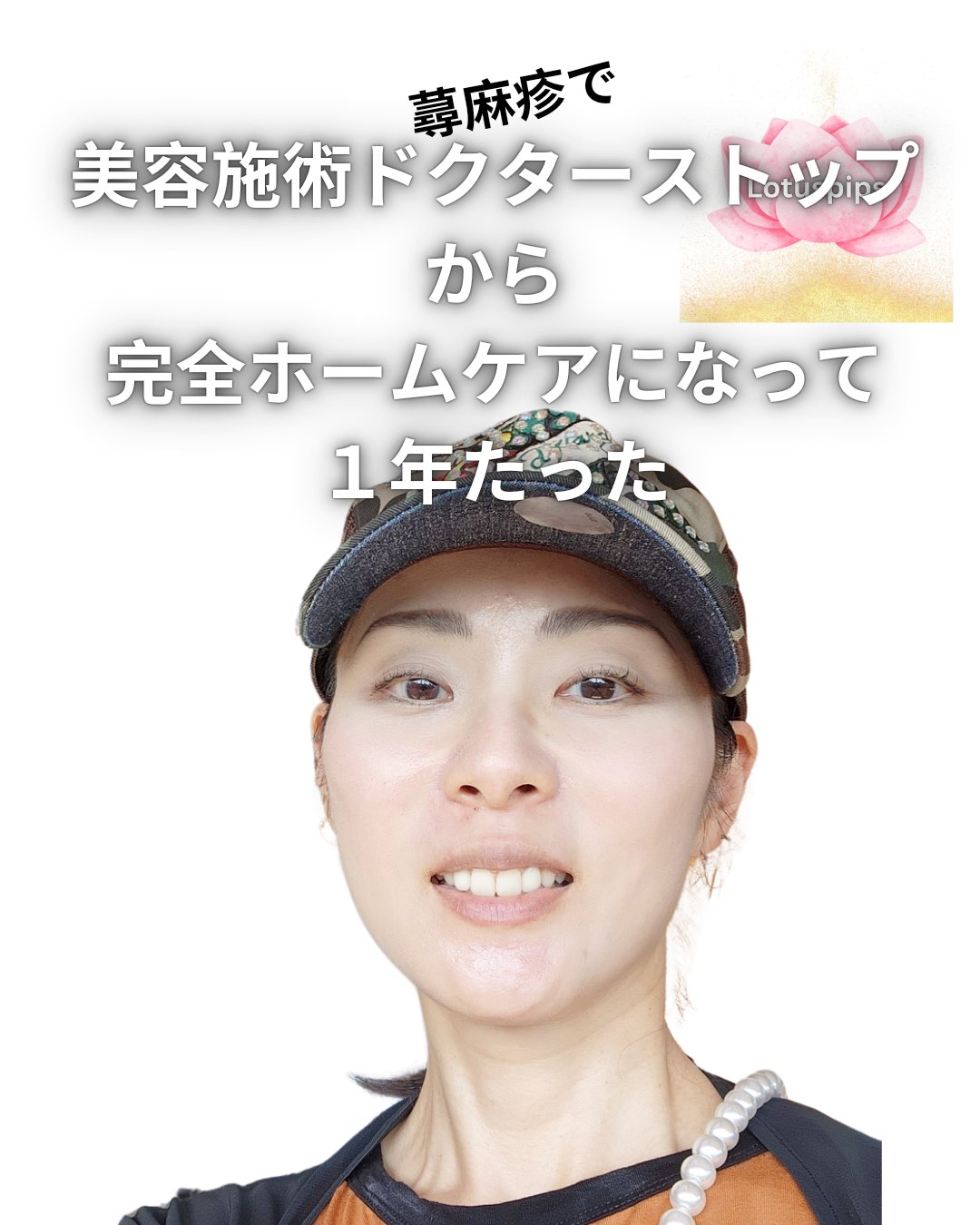 ドクダミLHAモイスチャーピーリングジェル/Anua/ピーリングを使ったクチコミ（1枚目）