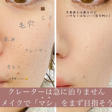 おゆみ|ニキビ・ニキビ跡ケア on LIPS 「【正しいケアなら時間が味方するって知ってる？】﻿﻿﻿「時間」﻿..」（1枚目）