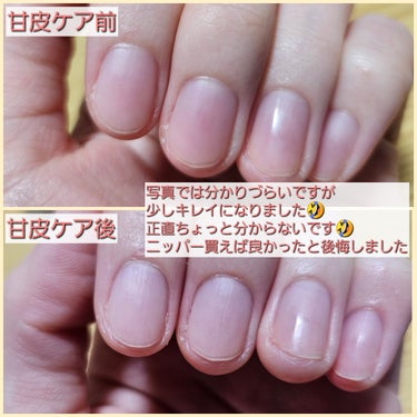 キューティクルプッシャー&リムーバー/ORLY/ネイル用品を使ったクチコミ（3枚目）