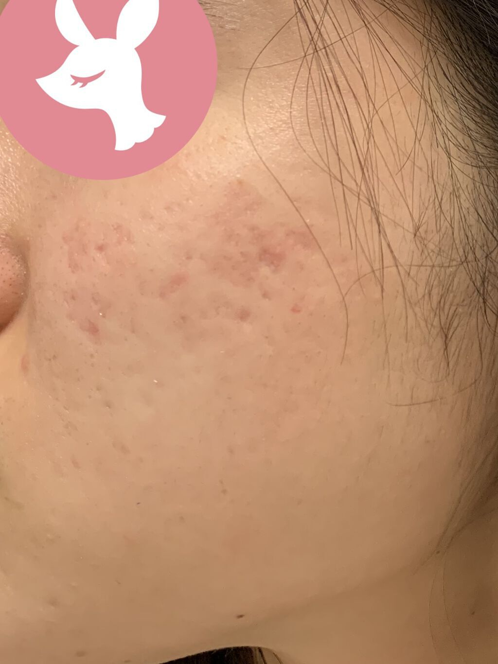 薬用パウダー化粧水/メンソレータム アクネス/化粧水を使ったクチコミ（3枚目）