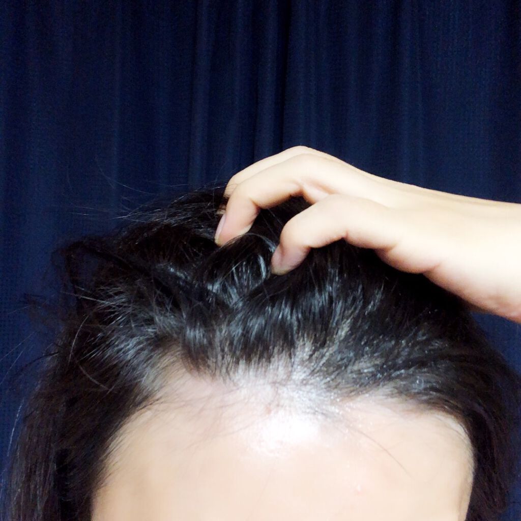 育毛スプレー ボリュームケア/セグレタ/頭皮ローションを使ったクチコミ（3枚目）