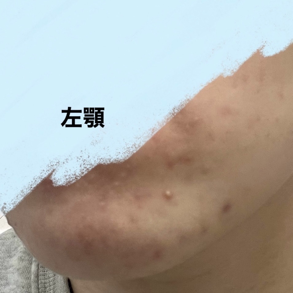 ミノン アミノモイスト モイストチャージ ミルク/ミノン/乳液を使ったクチコミ（2枚目）