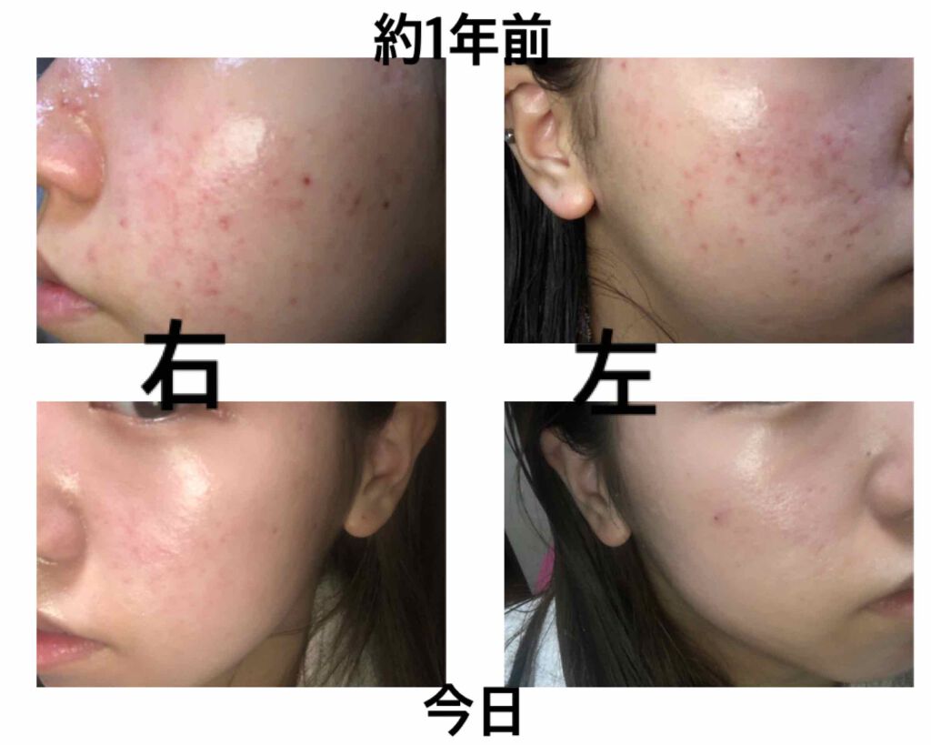 ガラクトミー ナイアシンエッセンス/manyo/美容液を使ったクチコミ（2枚目）