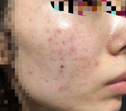 ã䜿ã£ãã¯ãã³ãïŒ2æç®ïŒ