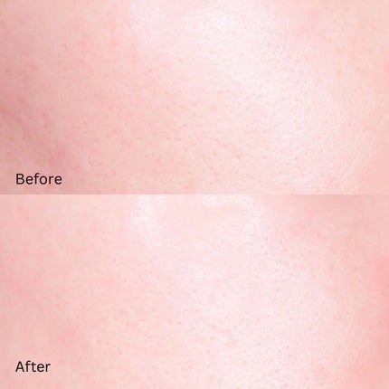 ポアタイトニングブーストセラム/CELORABY/美容液を使ったクチコミ(4枚目)