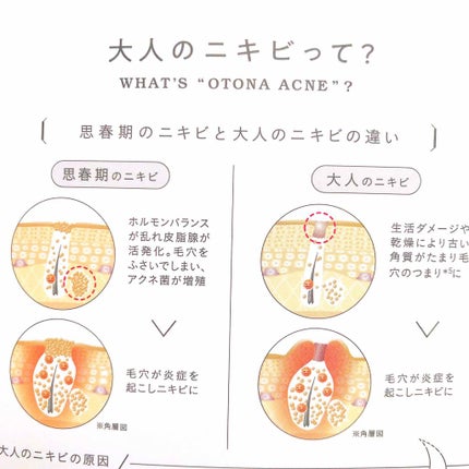 ファイバーフォーム/ルナメアAC/洗顔フォームを使ったクチコミ(3枚目)