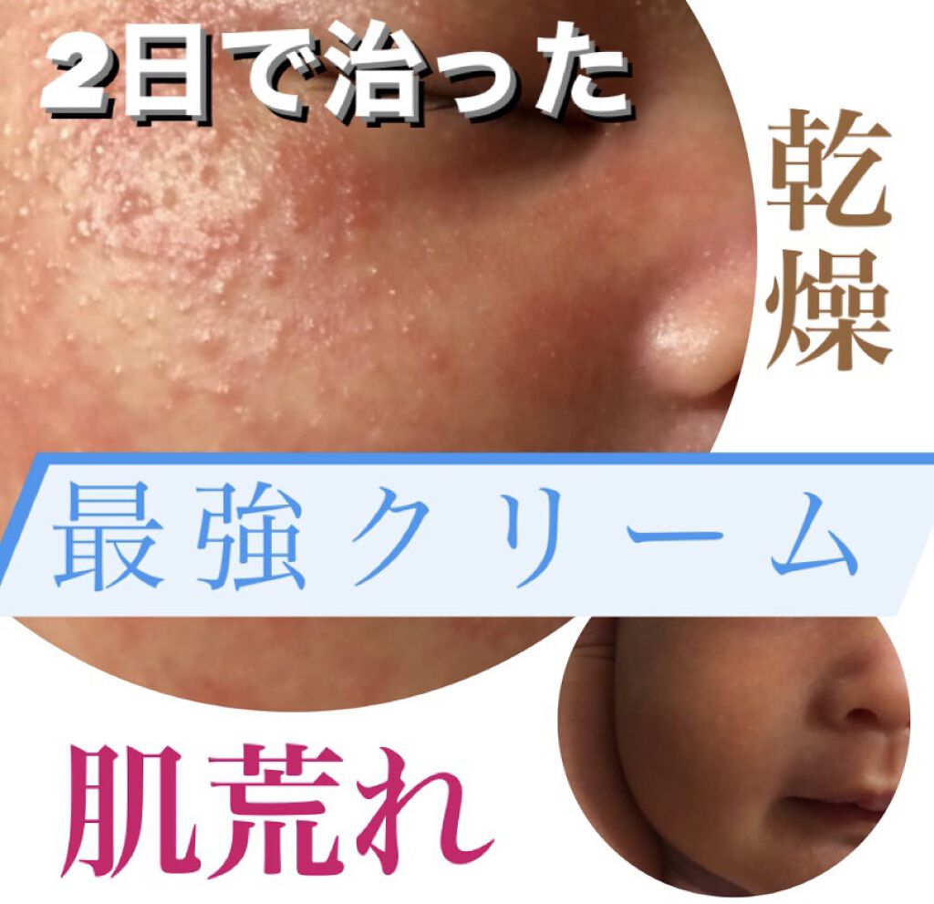 ベビークリーム/ピジョン/ボディクリームを使ったクチコミ（1枚目）