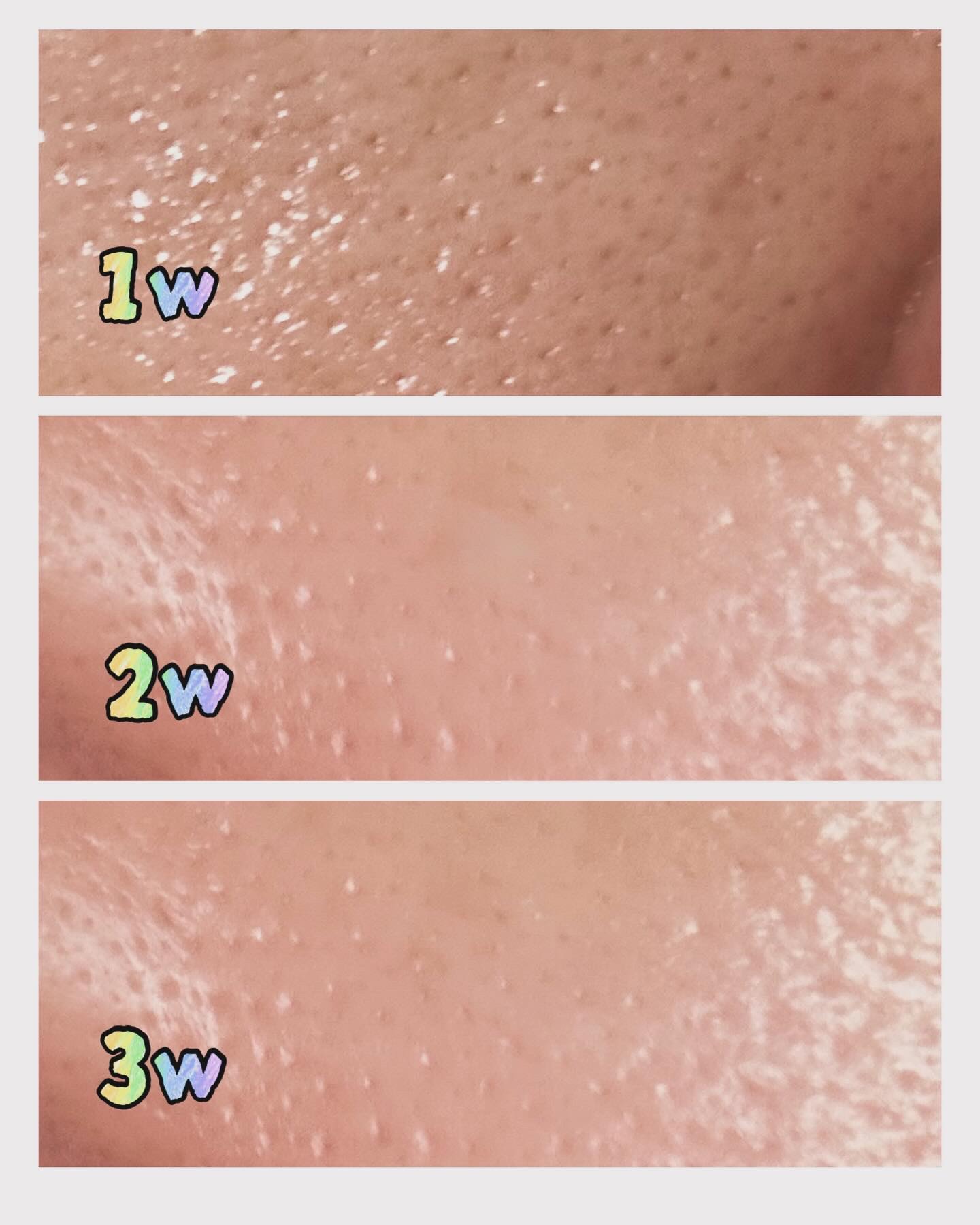 ビタペアC ビタレチ美容液/ネイチャーリパブリック/美容液を使ったクチコミ（2枚目）