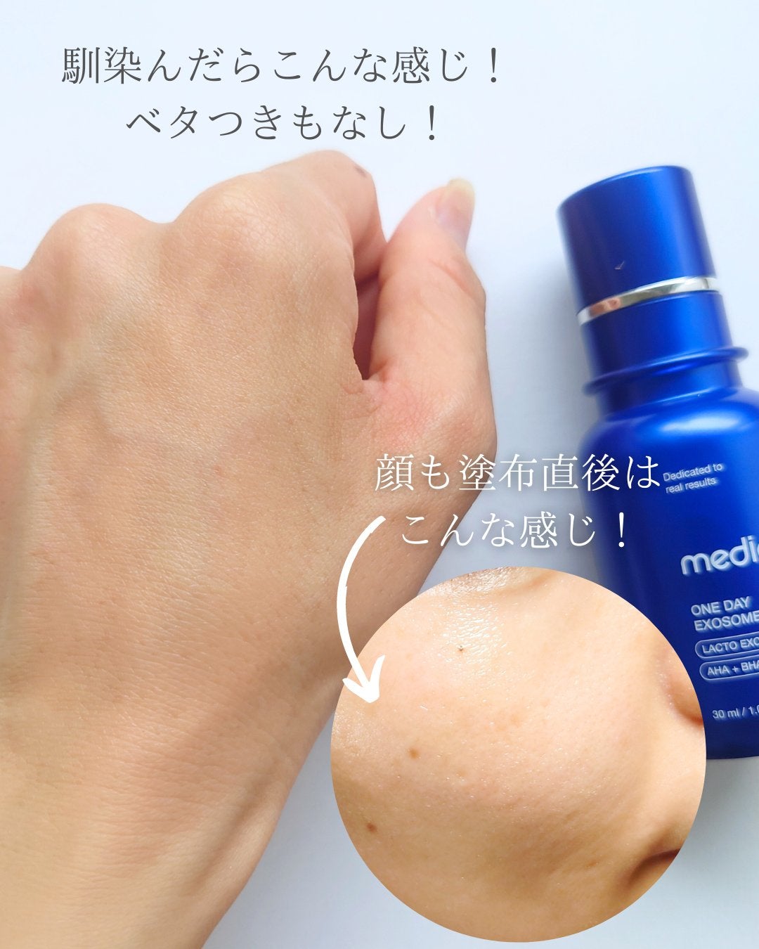 ゼロ1DAYエクソソームショット7500/MEDICUBE/美容液を使ったクチコミ(4枚目)