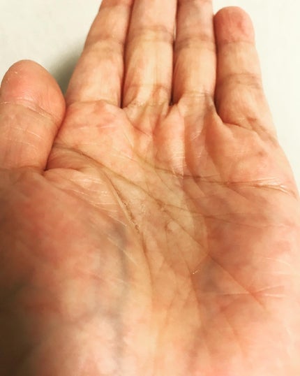 ヘパトリート 薬用保湿化粧水/ゼトックスタイル/化粧水を使ったクチコミ(5枚目)