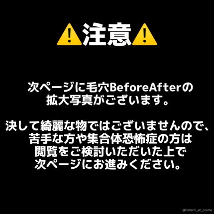 エマルジョンリムーバー 300ml/200ml/水橋保寿堂製薬/その他洗顔料を使ったクチコミ(6枚目)
