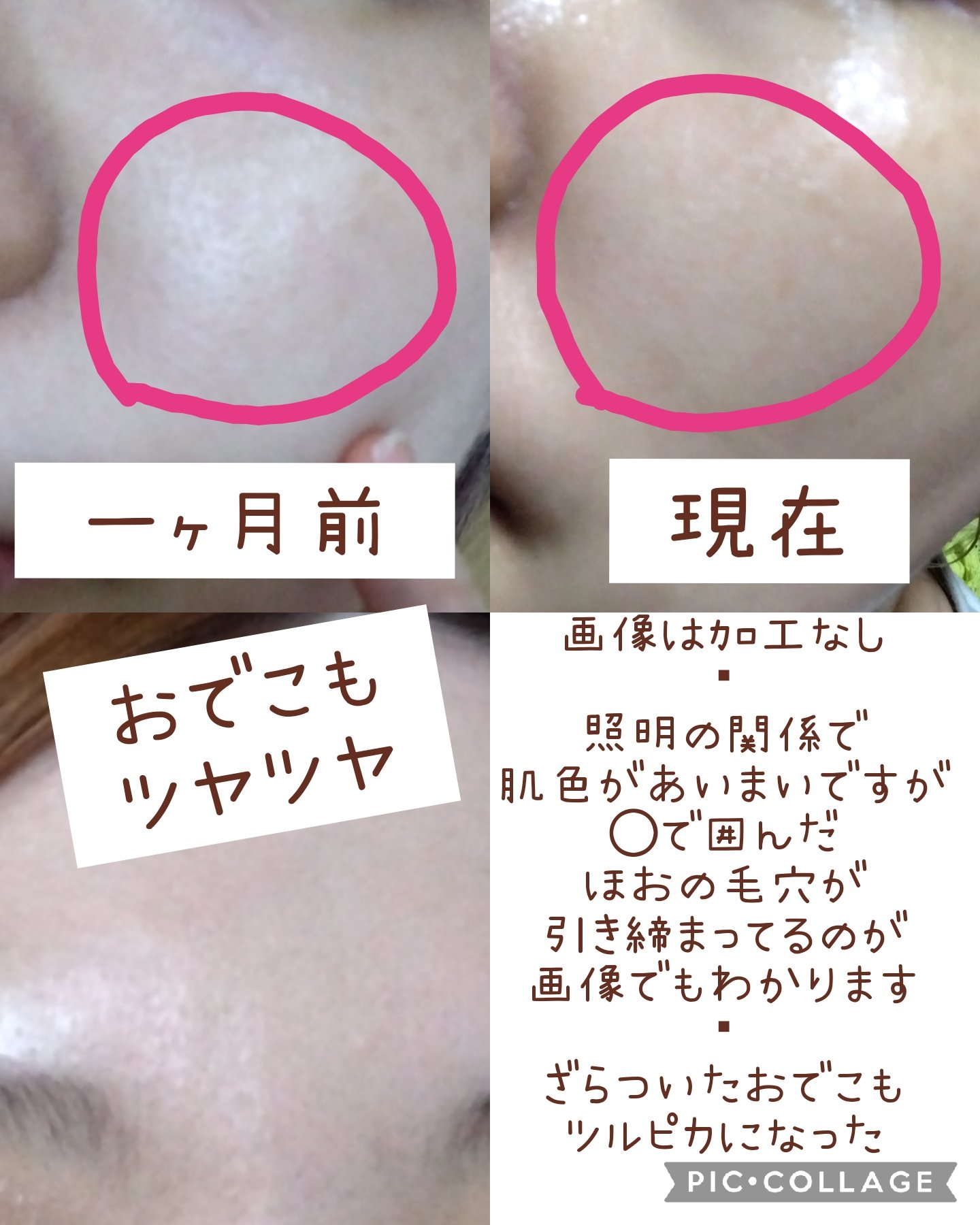 RXザ・ビタミンC23セラム/COSRX/美容液を使ったクチコミ（3枚目）