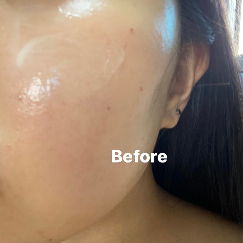 ユース ラディアンス ビタチノール セラム/primera/美容液を使ったクチコミ(6枚目)