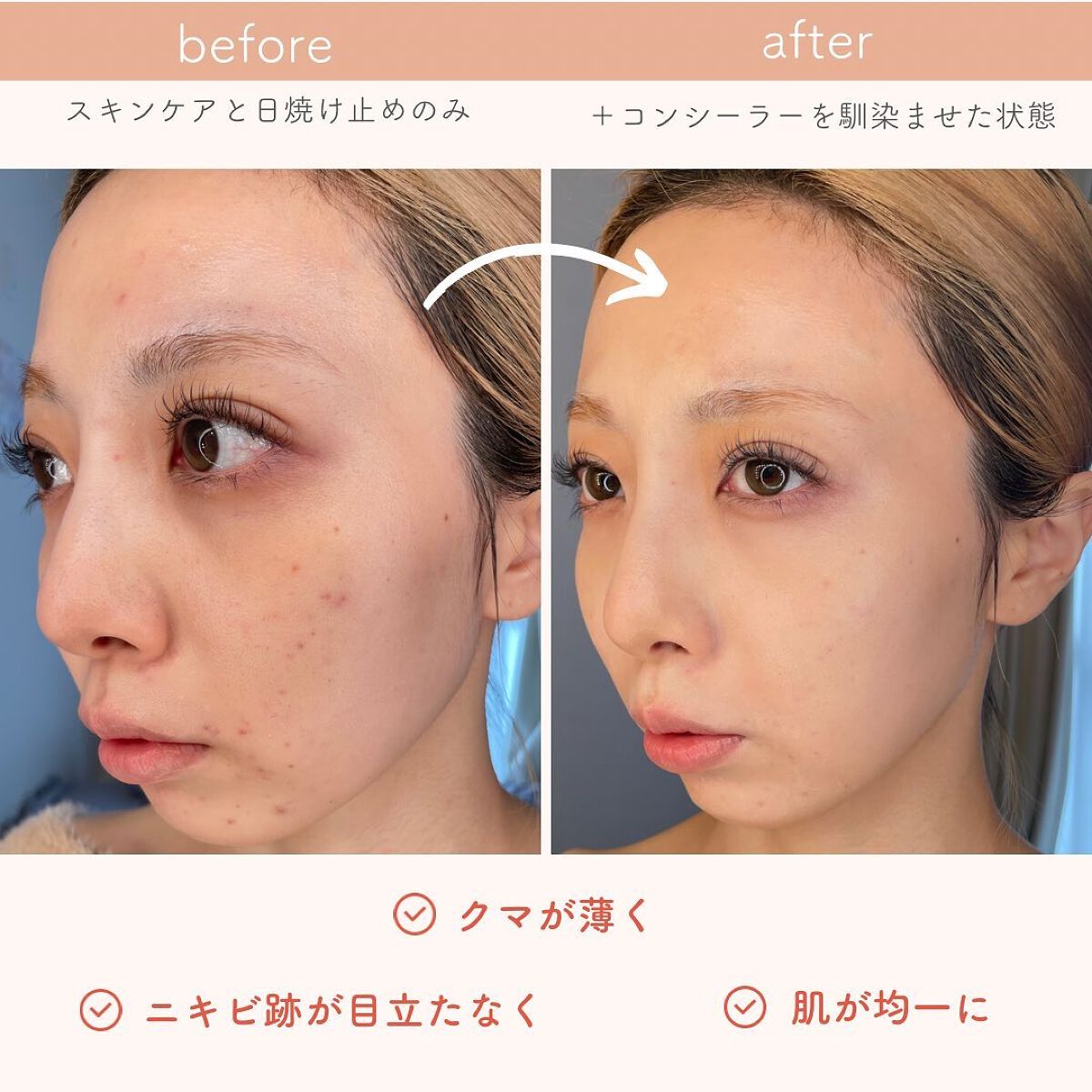 プロコンシーラーパレット/dasique/パレットコンシーラーを使ったクチコミ(8枚目)