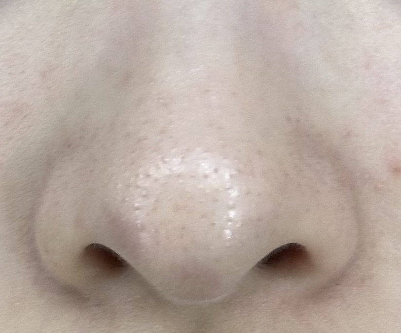 アンドハニー クレンジングバーム ブラック ミニサイズ 20g/&honey/クレンジングバームを使ったクチコミ（2枚目）