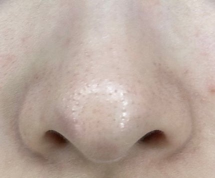 アンドハニー クレンジングバーム ブラック/&honey/クレンジングバームを使ったクチコミ(2枚目)