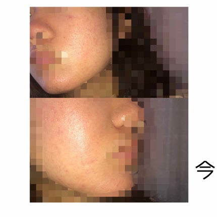 デュオ ザ クレンジングバーム/DUO/クレンジングバームを使ったクチコミ(4枚目)