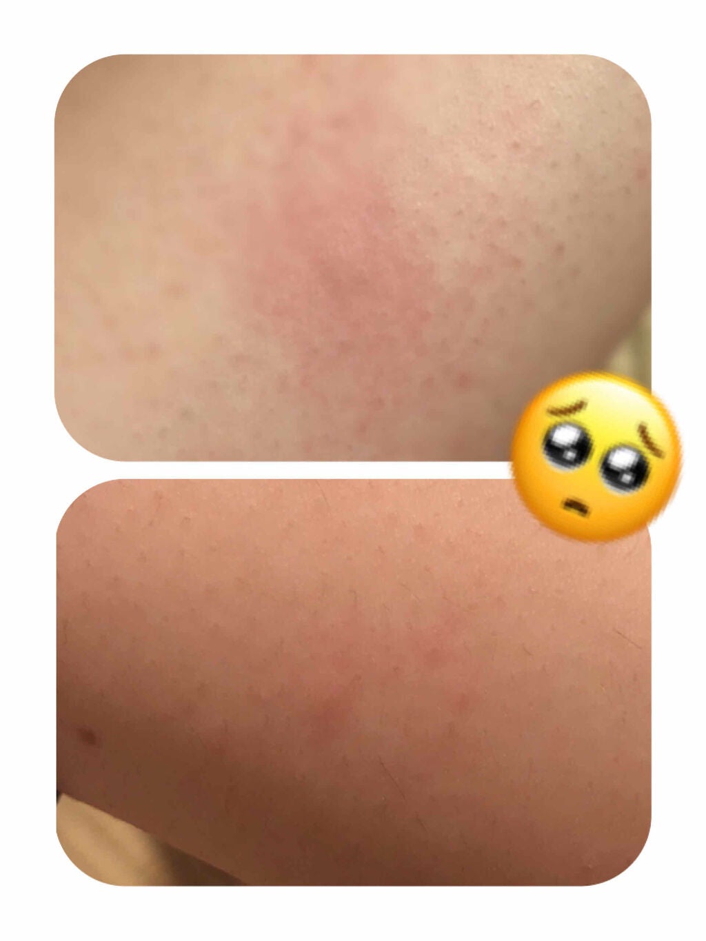 凛茶 on LIPS 「こんばんは🙌今日ご紹介するのは〜ゼロファクターさんの『Zリムー..」(4枚目)