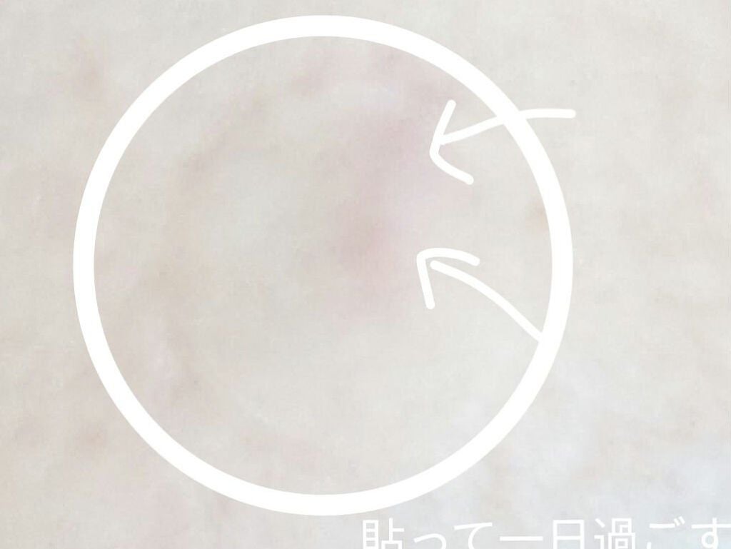 アクネピンプルマスターパッチ /COSRX/にきびパッチを使ったクチコミ(4枚目)