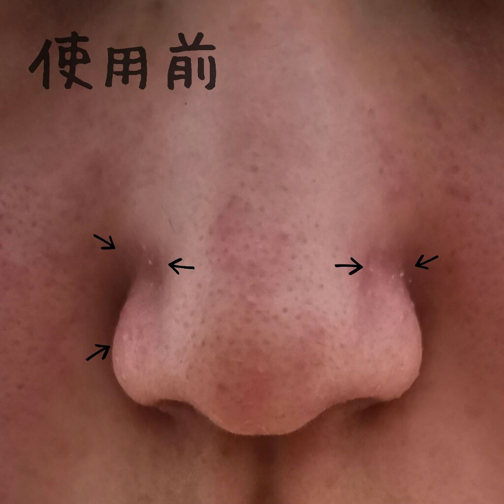 ベビーオイル ナチュラル/DAISO/ボディオイルを使ったクチコミ(5枚目)