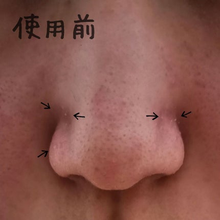 ベビーオイル ナチュラル/DAISO/ボディオイルを使ったクチコミ(5枚目)