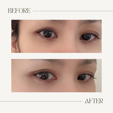 メザイク クリップ カッター ファイバー専用カッター/メザイク/二重まぶた用アイテムを使ったクチコミ(5枚目)