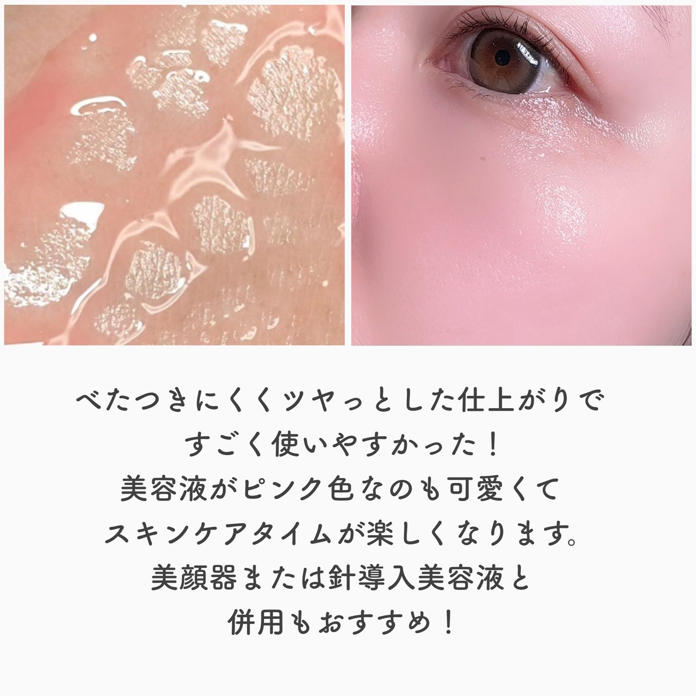 PDRNピンクアンプル PDRN 10,000ppm配合/MEDICUBE/美容液を使ったクチコミ(5枚目)