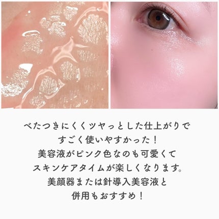 PDRNピンクアンプル PDRN 10,000ppm配合/MEDICUBE/美容液を使ったクチコミ(5枚目)