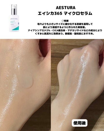 エイシカ365マイクロセラム/AESTURA/美容液を使ったクチコミ(2枚目)