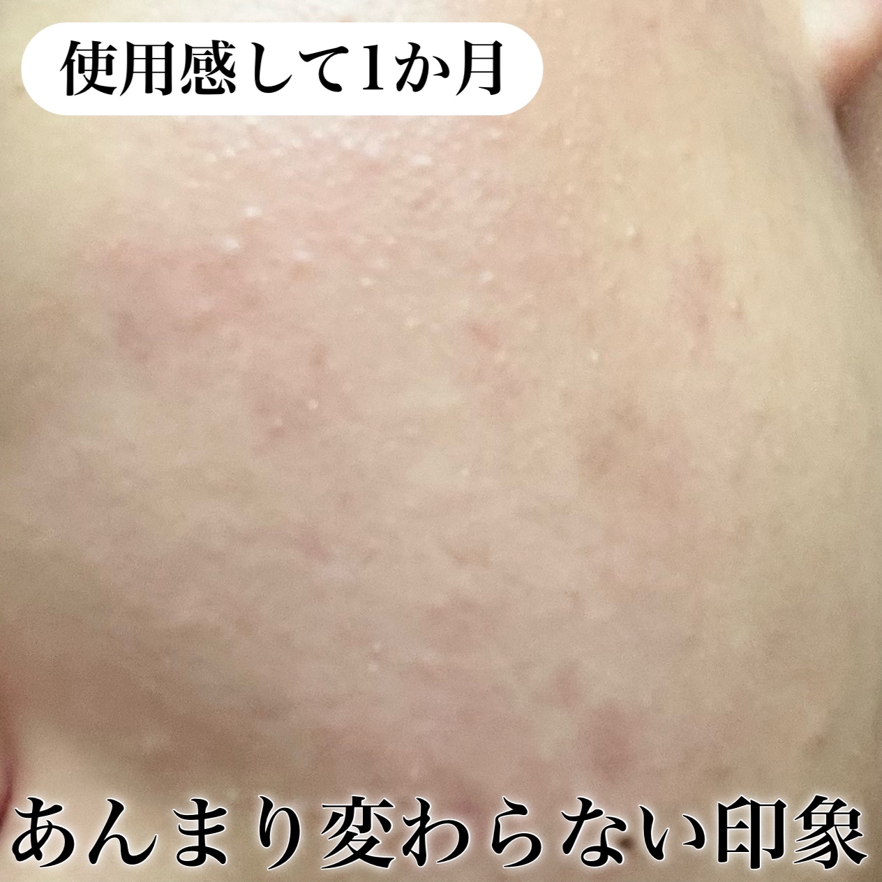 マジックカタツムリクリーム/ブラン/フェイスクリームを使ったクチコミ（3枚目）