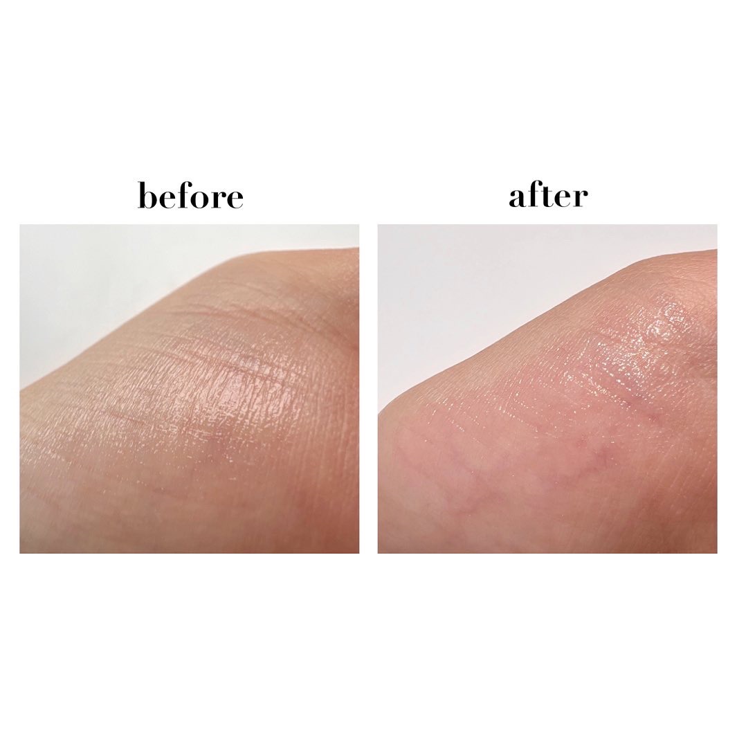 ティントリップレスキュー/FRESHO2/リップバームを使ったクチコミ（3枚目）