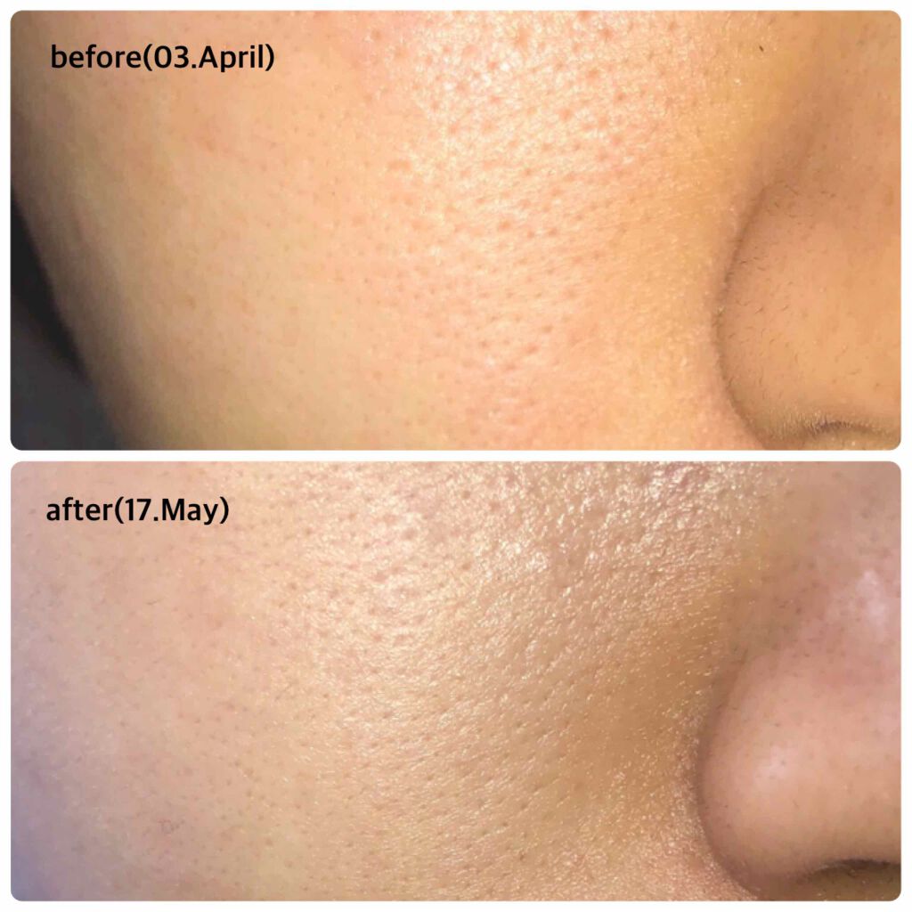 フレッシュリージュースドビタミンドロップ(35ml)/Klairs/美容液を使ったクチコミ（2枚目）