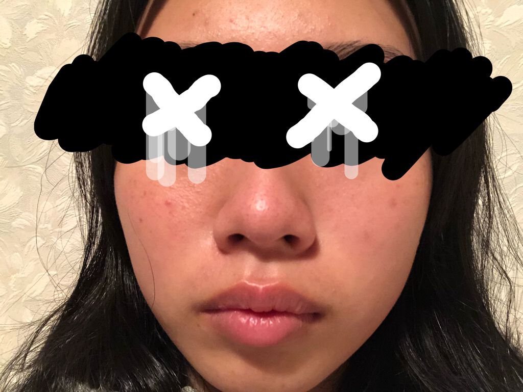 艶肌ドロップ/ラッシュ/美容液を使ったクチコミ（3枚目）