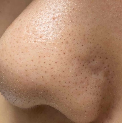 ハトムギ化粧水(ナチュリエ スキンコンディショナー R )/ナチュリエ/化粧水を使ったクチコミ(4枚目)