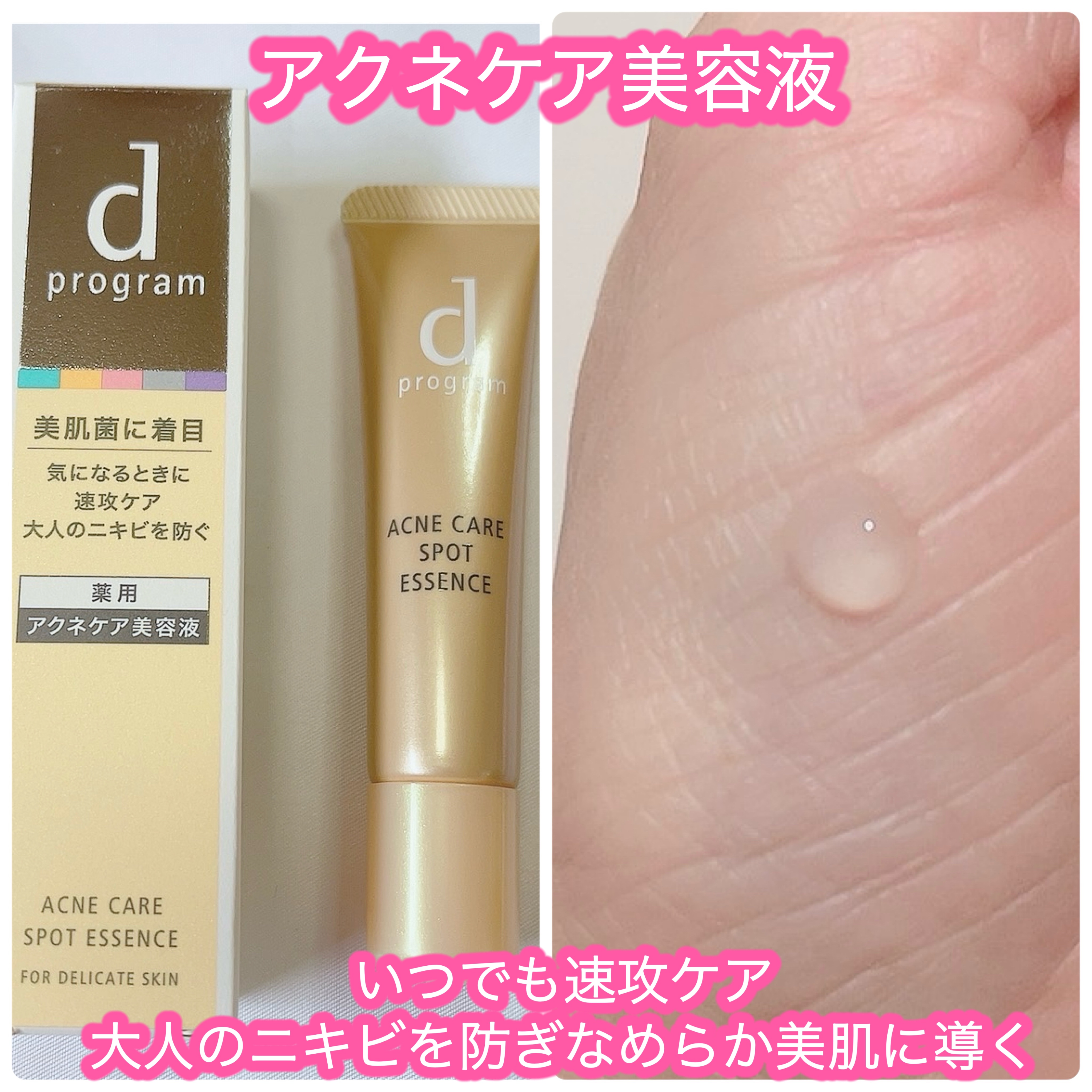 薬用 アクネケア美容液/d プログラム/美容液を使ったクチコミ（3枚目）