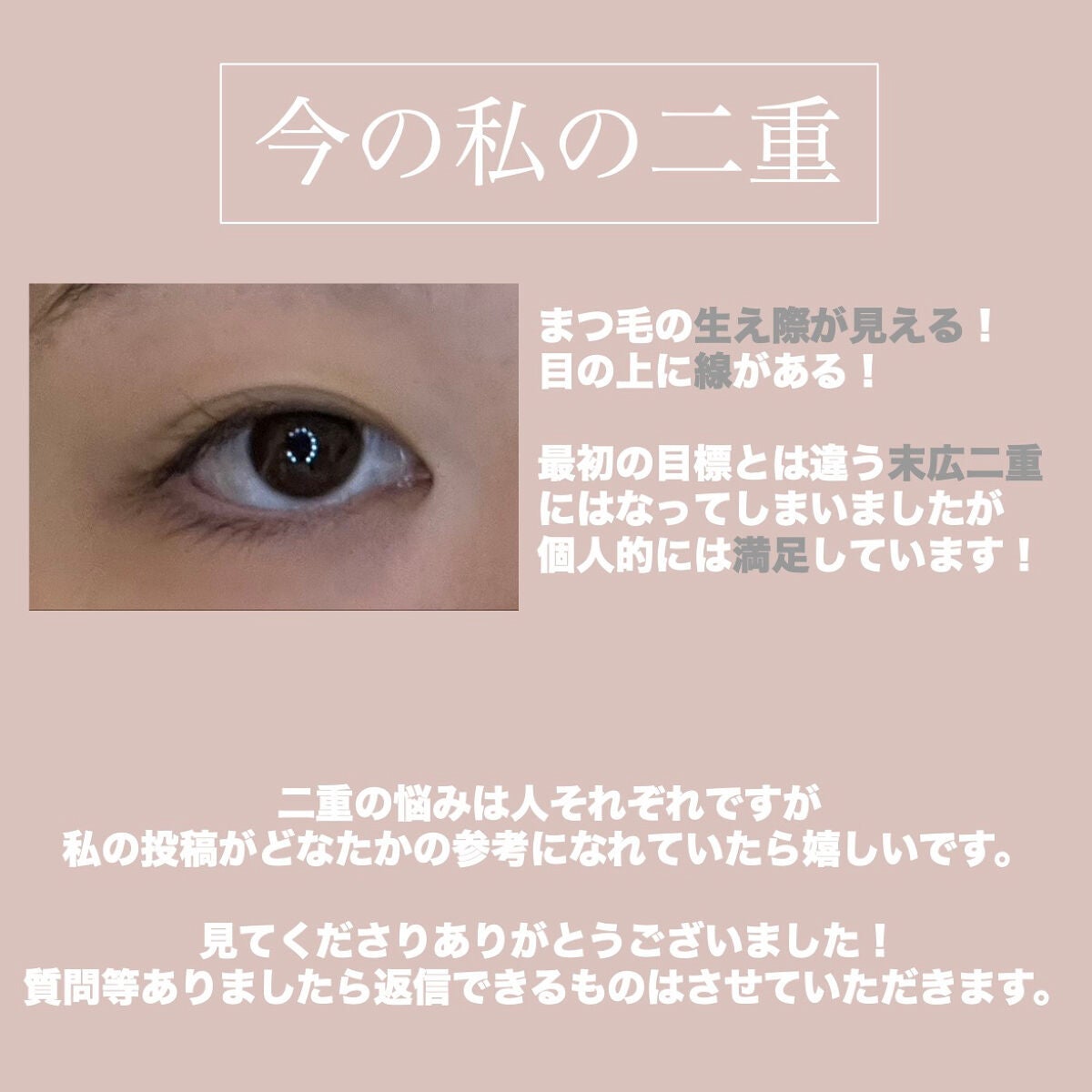 ワンダーアイリッドテープ Extra/D-UP/二重まぶた用アイテムを使ったクチコミ(6枚目)