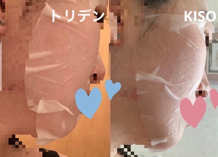 ビタミンC誘導体 マスク/KISO/シートマスク・パックを使ったクチコミ(5枚目)