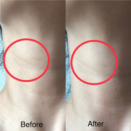 ベラ アルティメットエージ ネッククリーム/VELLA/フェイスクリームを使ったクチコミ(4枚目)