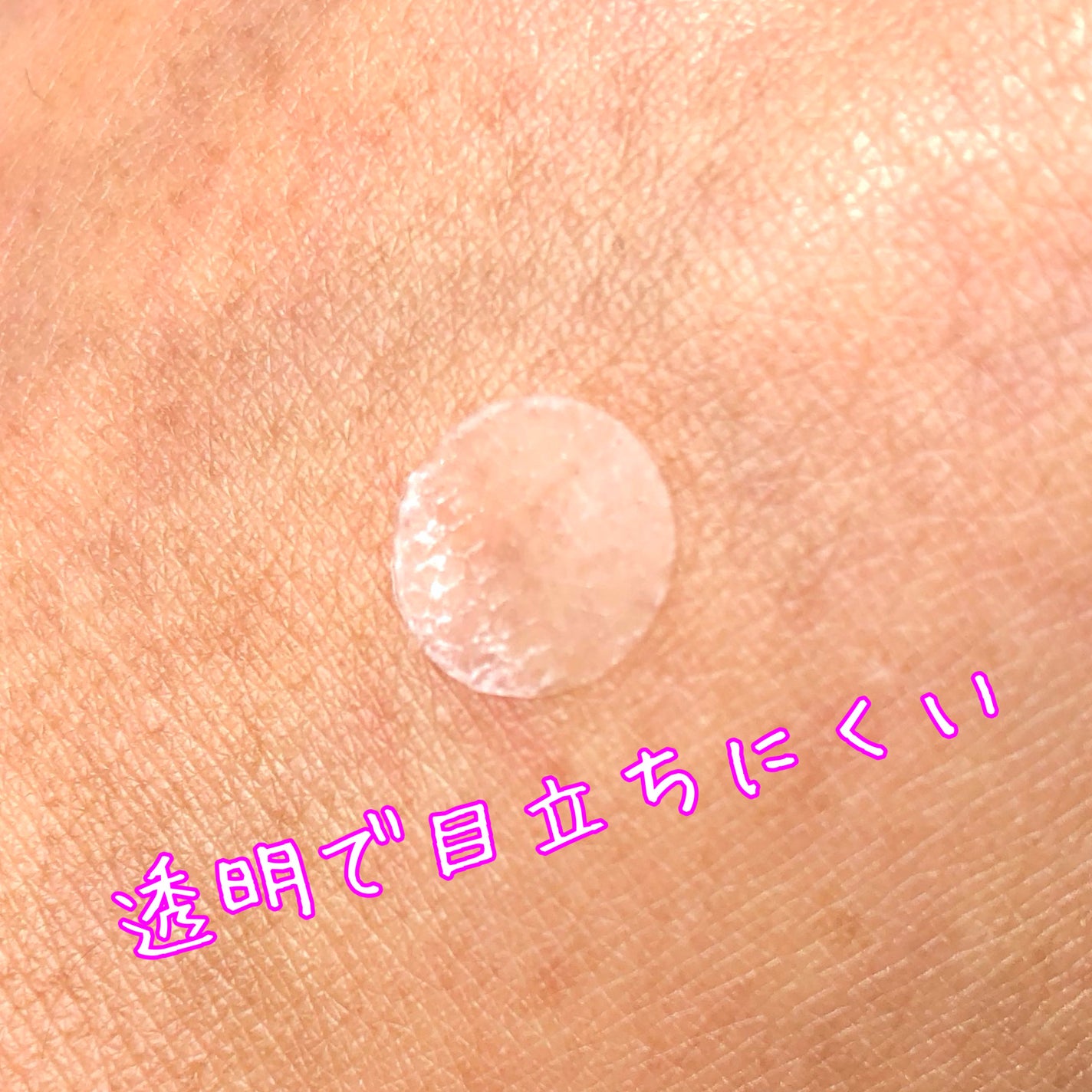 SPOT PATCH ロールタイプ/Shupong/にきびパッチを使ったクチコミ(4枚目)