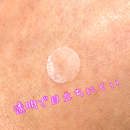 SPOT PATCH ロールタイプ/Shupong/にきびパッチを使ったクチコミ(4枚目)